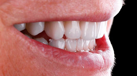 вирівнювання зубів